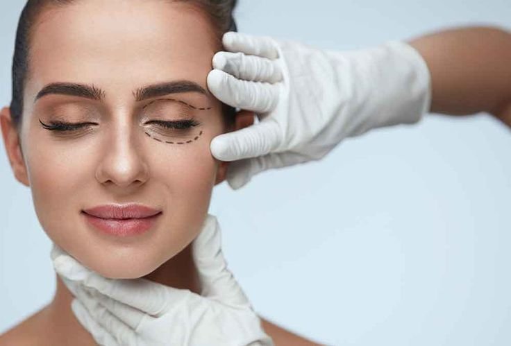 Blepharoplasty