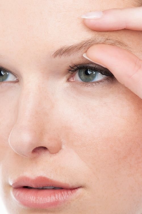 Brow Lift